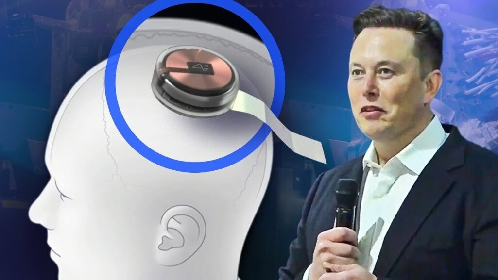 Elon Musk's Neuralink could reverse permanent hearing loss, make people hear agai