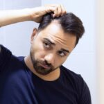Bald before 25: The silent crisis Gen Z men don't talk about